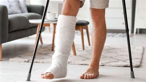 4 Signs To Know If You Have A Broken Leg Elite Hospital Kingwood