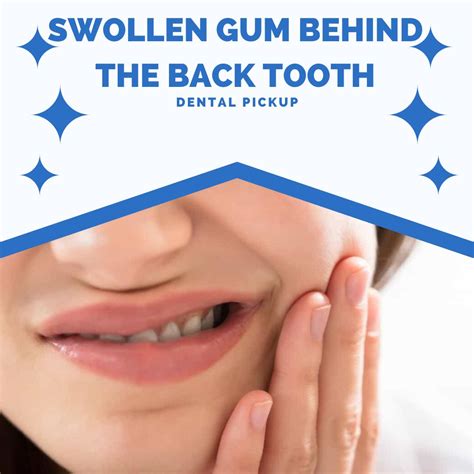 Swollen Gum Behind The Back Tooth Wisdom And Without Wisdom Tooth