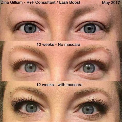 After Chemo Dina Started Using Lash Boost On Her Lashes And Brows