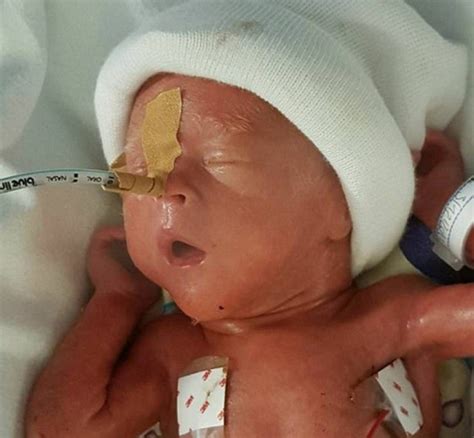 Baby Born At Weeks Weighing Less Than An Ipad Shows Humanity Of