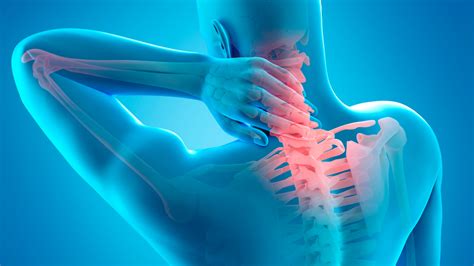 Neck Pain Jacksonville Fl Jax Spine And Pain Centers