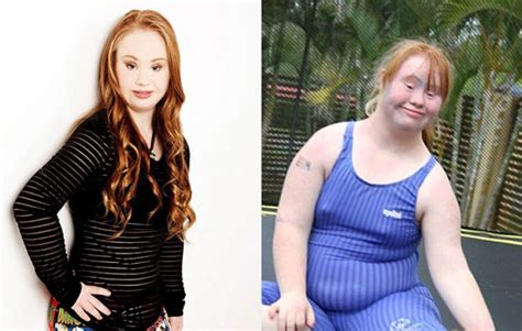 Inspiring Teen Model With Down Syndrome Earns 2 Clothing
