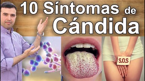 S Ntomas Y Signos Que Indican Que Tienes Candidiasis S Ntomas Que