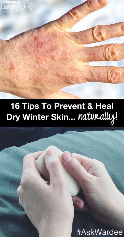 8 Home Remedies To Combat Dry Skin Artofit