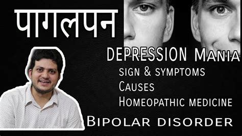 Bipolar Disorder Homeopathic Medicine For Bipolar Disorder Top