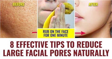 18 Effective Ways To Reduce Large Facial Pores