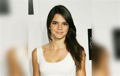 Kendall Jenner S Plastic Surgery Exposed By Top Docs