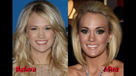 Did Carrie Underwood Really Get Plastic Surgery Youtube