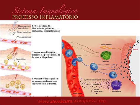 Com Relacao As Caracteristicas Observadas Na Resposta Inflamatoria Cronica