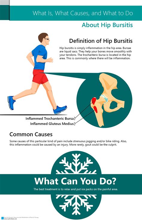 Infographic What Is What Causes And What To Do About Hip Bursitis My