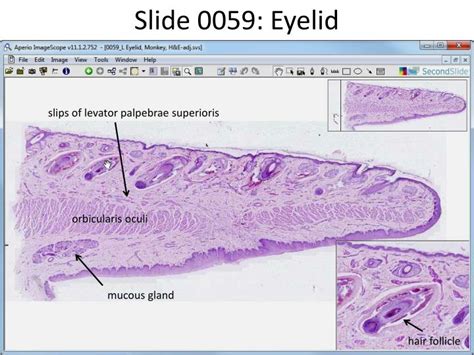 Ppt Slide 0059 Eyelid Powerpoint Presentation Free Download Id