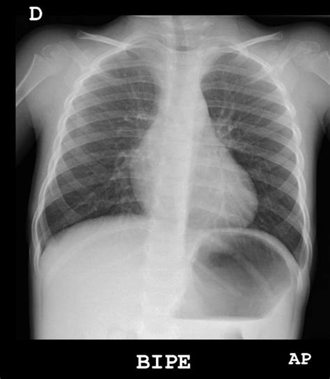 Continuum Radiografía de tórax indicaciones diagnóstico y casos