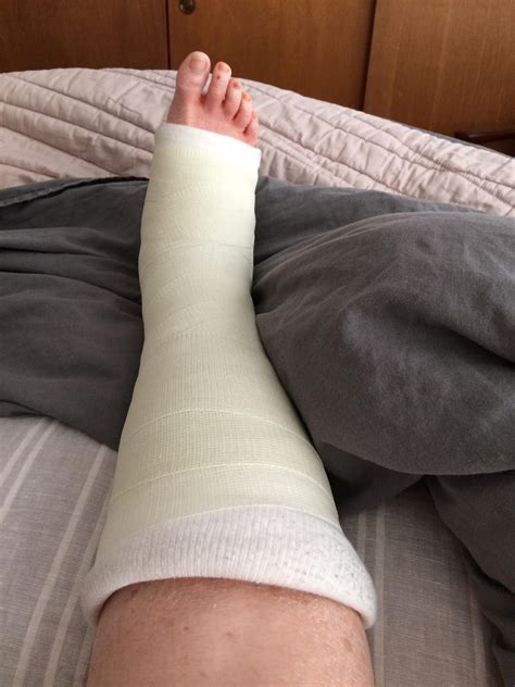 What to bring a friend recovering from surgery. Late To The Haight with Patricia Corrigan: Tips for ...