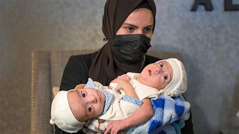 Iraqi Conjoined Twins Arrive In Riyadh For Possible Surgery Trendradars