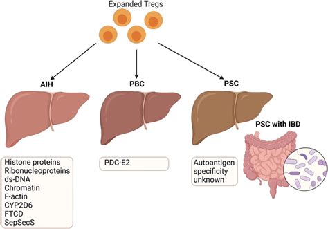 Antigens In Different Types Of Autoimmune Liver Diseases And Their Role