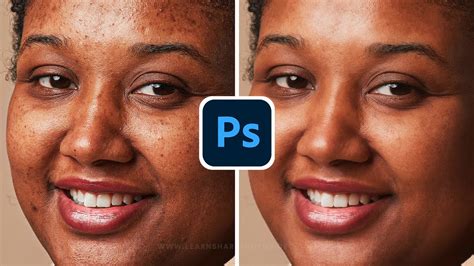 How To Remove Pimples From Face In Photoshop Skin Retouching And Photo