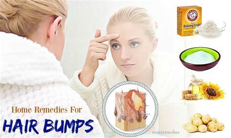 16 Home Remedies For Hair Bumps On Scalp Face Neck And Legs