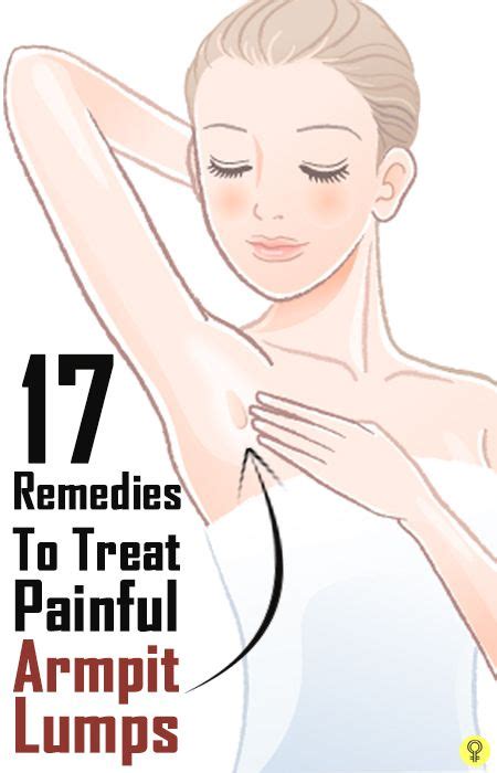 13 Home Remedies To Reduce Armpit Lumps Armpit Lump Swollen Lymph