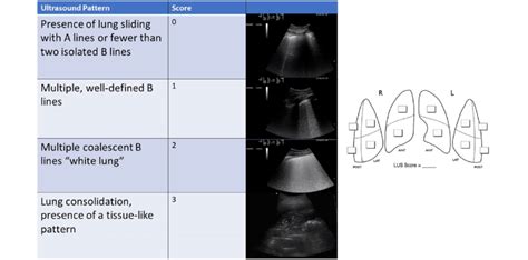 Lung Ultrasound Score Execution Scheme Download Scientific Diagram