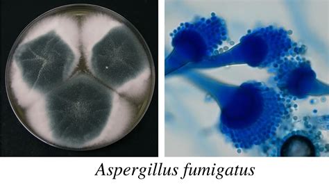 Aspergillus Morphology Clinical Features And Lab Diagnosis • Microbe