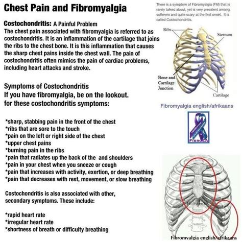 Costochondritis Symptoms Healing Pinterest It Is In My Life And