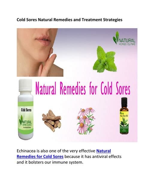 Ppt Cold Sores Natural Remedies And Treatment Strategies Converted