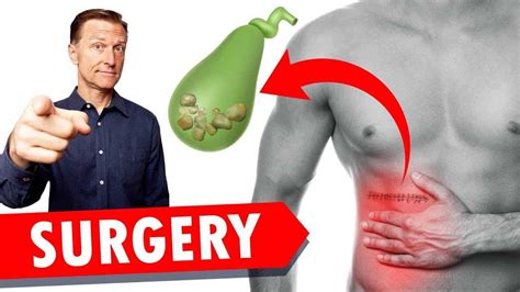 Gallbladder Surgery Removal And 10 Benefits Of Bile