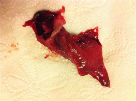 Maybe you would like to learn more about one of these? Miscarriage help!! (Warning graphic) - BabyCenter