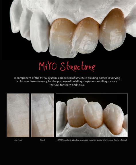 Miyo Esthetic System Bring Your Monolithic To Life