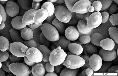 Saccharomyces Cerevisiae Wikipedia