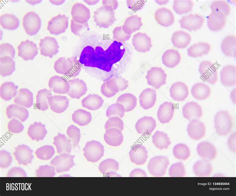 Monocyte Cell White Image And Photo Free Trial Bigstock