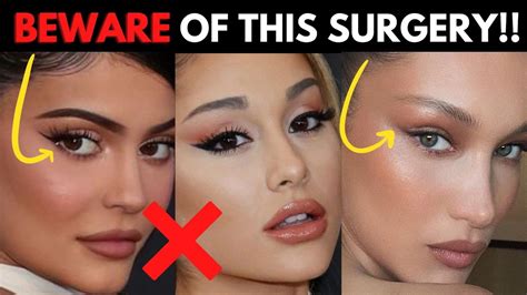 Why Youll Regret Getting This Trendy Plastic Surgery Procedure Fox Eye Surgery Trend Youtube