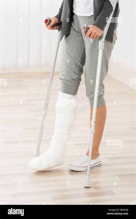 Woman Using Crutches While Walking Stock Photo Alamy