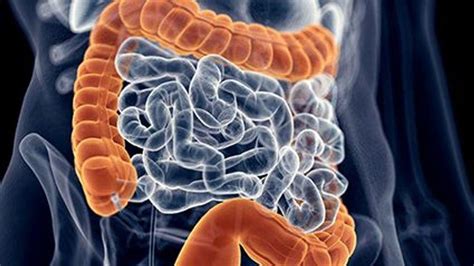 Guidance Updated For Managing C Difficile Infection In Adults