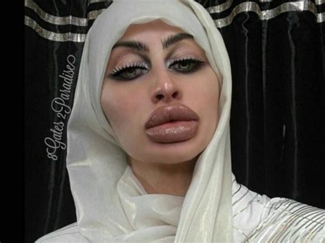 World Record Breaker She Has The Biggest Lips In The World Demotix Big Lips Full Lips Bad