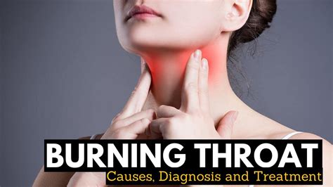 What Causes Burning Throat And Its Treatment Youtube