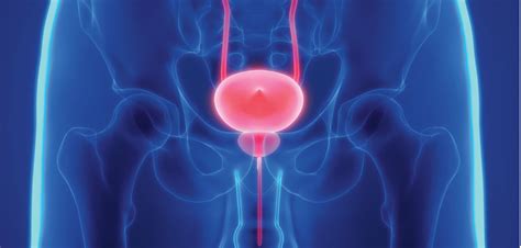 Advanced Prostate Cancer Diagnoses Rose Even After Shift In Testing