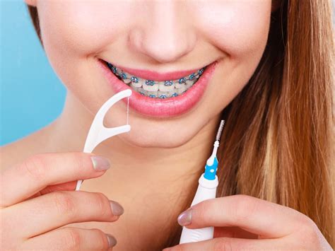 4 Tips For Flossing With Braces Dentist Near Me
