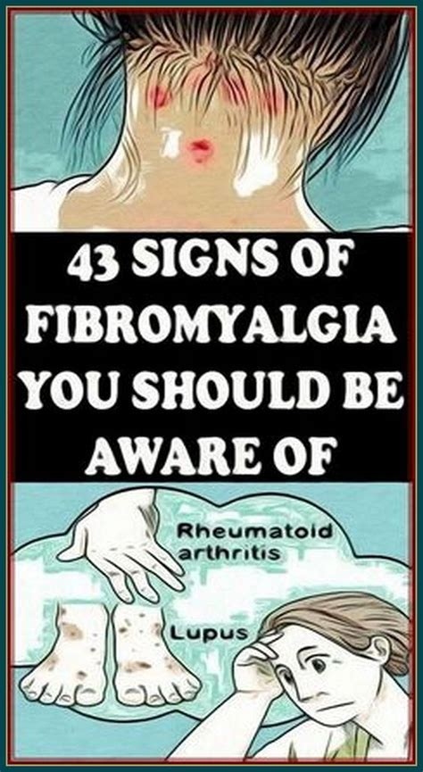 43 Fibromyalgia Signs You Should Be Aware Of