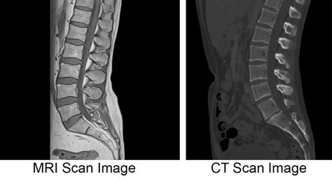 Mri Vs Ct Scan Diagnosing Spine And Neck Injuries And Degenerative