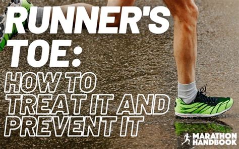 5 Ways To Prevent And Treat Runners Toe And The Best Ways To Get Back
