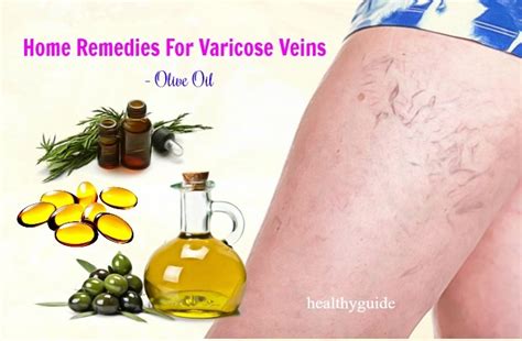 21 Natural Home Remedies For Varicose Veins Pain On Face And In Feet Legs