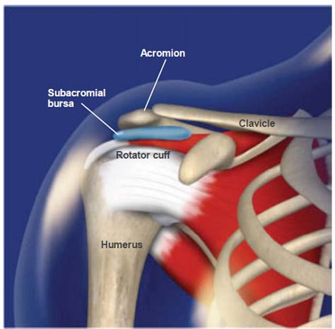 Shoulder Impingement Syndrome Symptoms And Treatments
