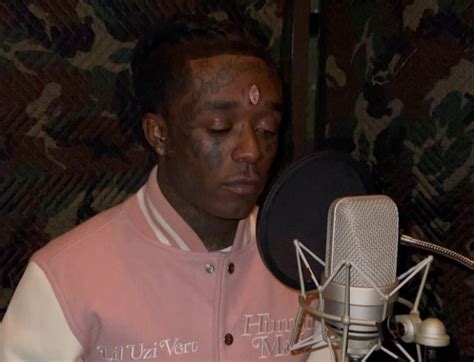 Lil Uzi Vert Gets 24 Million 11 Carat Pink Diamond Implanted In His Head