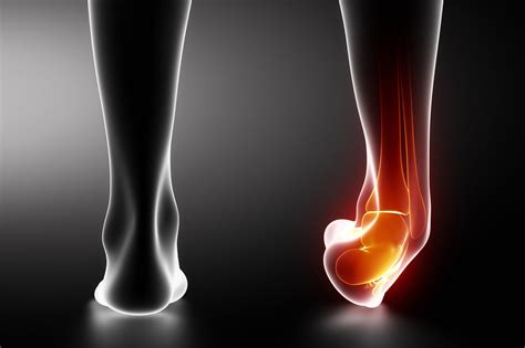 Ankle Foot Focus Podiatry Perth Podiatrists