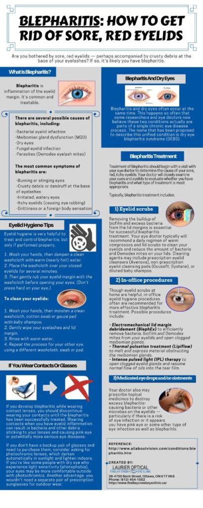 Blepharitis How To Get Rid Of Sore Red Eyelids Latest Infographics