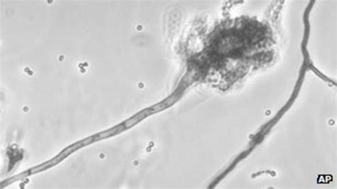 Us Fungal Meningitis Toll Rises To 15 Bbc News