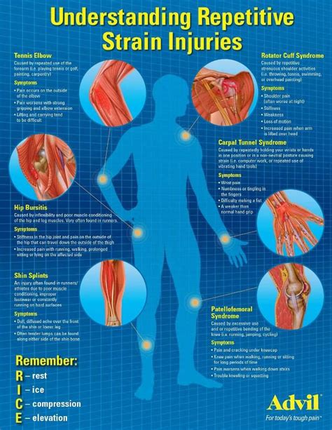 Understanding Repetitive Strain Injuries Remember Rice R Rest I