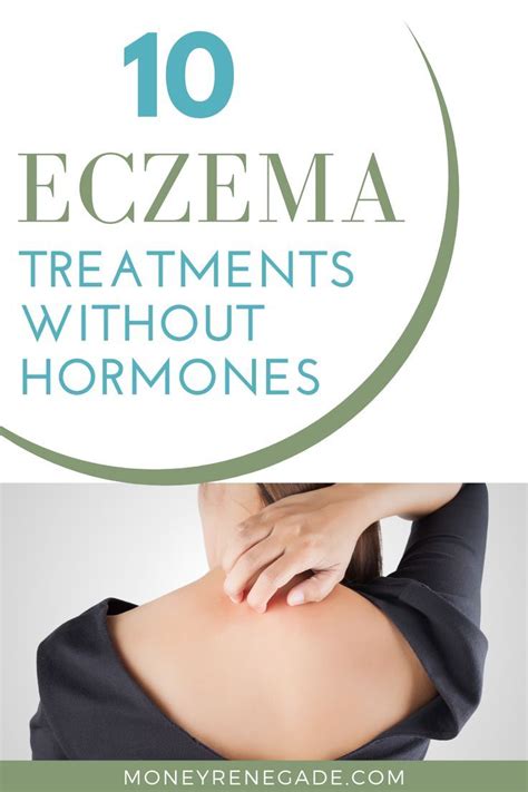 10 Natural Eczema Treatments With No Hormones With Images Eczema