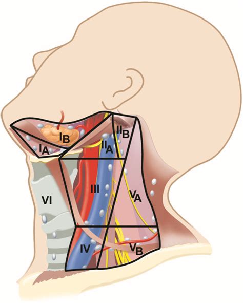 Assigned Lymph Node Levels Of The Lateral Neck Level Ia Submental